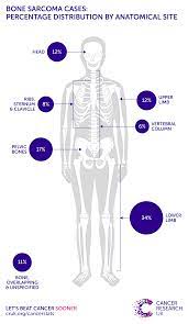 It is important that all. Bone Sarcoma Incidence Statistics Cancer Research Uk