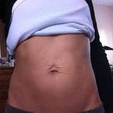 If a woman was overweight for a long time, the skin on the entire body has had time to stretch out. What Is The Best Procedure To Fix The Loose Skin Above My Navel And The Belly Button Appearance Photo