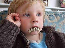 Brits have yellower, more irregular teeth than americans. English People Have Bad Teeth Bad Teeth People English People