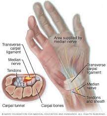 Athens Ga Carpal Tunnel Syndrome Reddy Medical Group