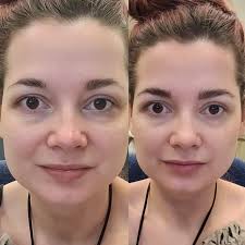 A lil bit of NK beautification... IUONSE 協.S子 BUSHESSPARE HESS SS 戸入品