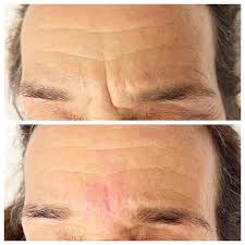 Dr. Gavin M. Davison (@thetravelingsurgeonmd) • Instagram photos and videos