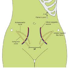 This entry technique should be used routinely in urologic laparoscopic surgeries. Vessels And Nerves Of The Anterior Abdominal Wall And Location Of The Download Scientific Diagram