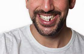 5 Ways To Replace A Missing Tooth