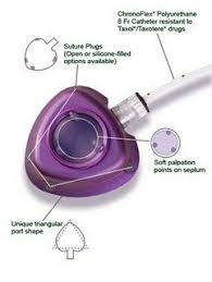 Infusaport Mediport Catheter Sjogrens Catheter Sjogrens Syndrome
