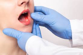 That means treatment will be faster and less disruptive. Let S Talk About Oral Cancer With Dr Alice Fitzgibbon Professional Builder