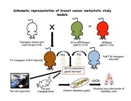 Learn about what breast lumps and other symptoms however, breast lumps are common, and not all of them are cancerous. Mouse Models Of Breast Cancer Metastasis Wikipedia