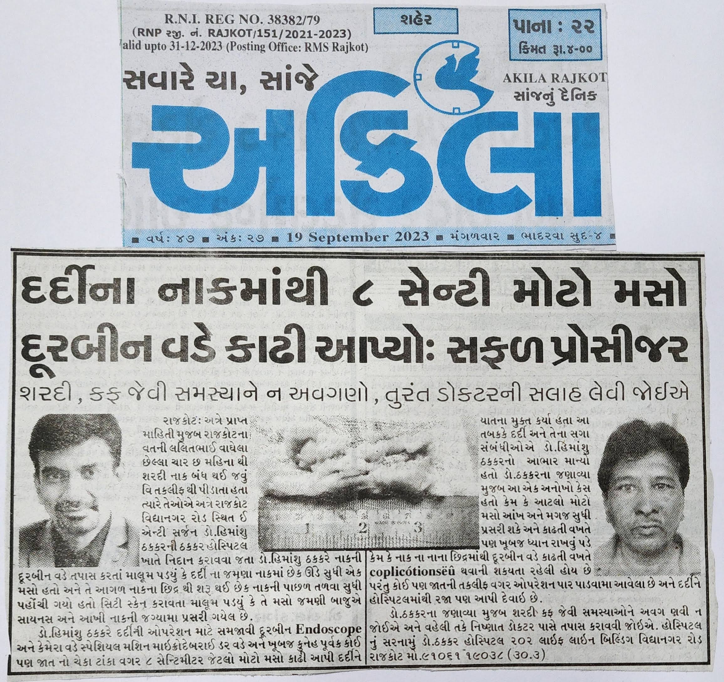 દર્દી ના નાક માંથી 8 સેન્ટી મોટો મસો દૂરબીન વડે કાઢી આપતા product image