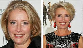 Sep 19, 2018 · learn more about the causes of jowls in this blog post. Double Chin Best Hairstyles For Sagging Jowls Novocom Top