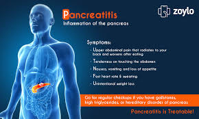 Pin On Healthcare Tips