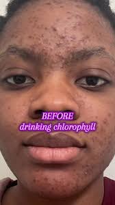 Skincare Journey: Exploring Chlorophyll Benefits