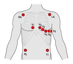 The algorithm is as follows Recording A 12 Lead Ecg Ekg First Aid For Free