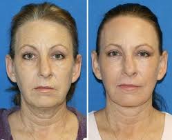 Strange Incident at London Heathrow Airport