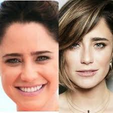 Não gostava do meu rosto, era muito redondo, pesquisei muito antes de fazer a bichectomia vi que celebridades internacionais e atrizes brasileiras fizeram esse procedimento, então decidi fazer, assim que conheci a dra fabiana nogueira e vi que ela é especialista nesse procedimento afirma andréa.fiz a bichectomia para afinar meu rosto e ainda resolvi um problema que tinha quando. 27 Ideias De Bichectomia Pacientes E Diversao Tomando Decisoes Tratamento Kit De Cuidado