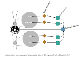 Image result for Chronic Functional Vomiting