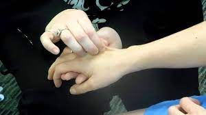 pv ue skin turgor 8 youtube