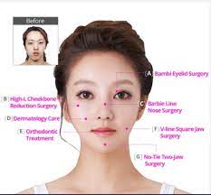 Can Plastic Surgery Fix An Ugly Face? - Quora