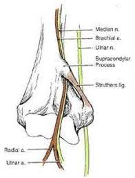 Pronator Syndrome Hand Orthobullets