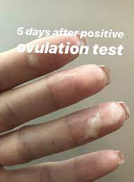 For people with regular cycles, ovulation typically occurs around day 14. What Is The Discharge After Ovulation