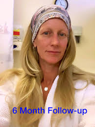 What happens during an oncology check up?