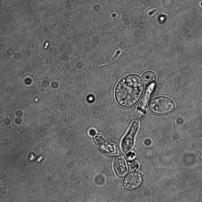 Check spelling or type a new query. Sui Generis Brewing Purifying Yeast From Infected Cultures Part 1