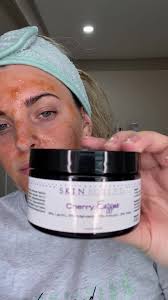 ❣️Valentine’s Day Special❣️ • • Cherry Chocolate Facial🍒🍫  #valentinesdayspecial #selfcare #valentinesday #facialtreatment  #licensedesthetician #estheticiantiktok #exfoliation #enzymemask  #skinscriptrx ...