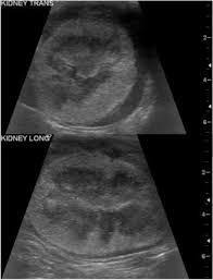 Case A Case Of Renal And Nervous Lymphoma In A Cat Vetpixel