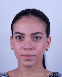 Dr. Javier Garnica (@drjaviergarnica) • Instagram photos and videos