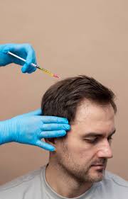 Best Hair Transplant in Dubai | Hair Clinic Dubai | Al Manara
