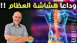 الدكتور كريم العلوي يبشر مرضى هشاشة العظام بوصفة قوية تبني العظام و تقويها youtube concert