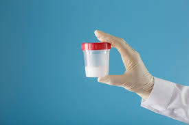 Sperma in einem glas zur analyse in der hand des arztes an einer blauen  wand | Premium-Foto