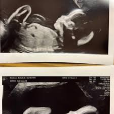 Beka and Mahto Addison-Browder's Baby Registry at Babylist