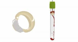 Fda Clears Bds Vacutainer Barricor Tube Plasma Blood