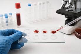 Image result for Agglutination Test