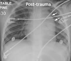 نتیجه جستجوی لغت [widened] در گوگل