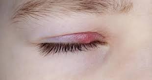 Image result for Blepharis affinis