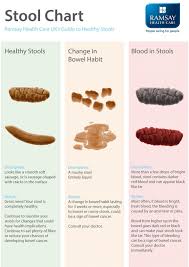 Colorectal cancer that has spread to the liver. memorial sloan kettering cancer center: Bowel Cancer Symptoms Bad Smell Poo Sign Of Healthy Stool Express Co Uk