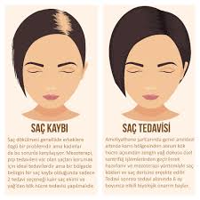 Kok Hucreyle Sac Tedavisi