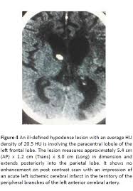 Patterns Of Traumatic Head Injury Among Patients That Underwent Craniofacial Computed Tomography Scan In Port Harcourt Metropolis Rivers State Nigeria Insight Medical Publishing