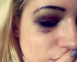 Domestic abuse in Eden Prairie