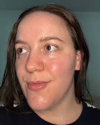 SonOfChike is the sonic therapy you need. Listen this morning for clear  skin 🤣