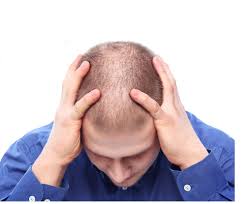 #2 lily, nov 10, 2014 farrah711 likes this. Hair Loss Low Testosterone Symptoms