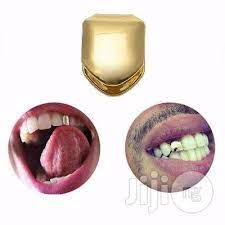 Custom designed tooth single grillz for the 4 front tooth (4 pieces of single cap) tight design makes it very convenient to wear all through the day. Gold Plated Small Single Tooth Cap Grillz In Ikeja Clothing Accessories Chidozie Okwuka Jiji Ng