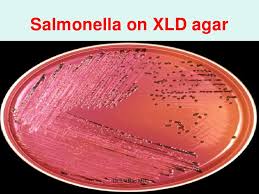 My name is kavindu lakmal , medical laboratory science student from university of peradeniya. Salmonella Basics