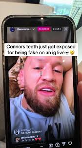 Connor Phillips Missing Tooth