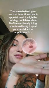 Mole in Front of Ear Meaning