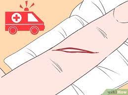 How To Treat A Cut Finger: 11 Steps (With Pictures) - Wikihow