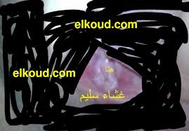 ترقيع غشاء البكارة 0022249165546 Bakara Salima صورالجهاز التناسلي الانثوي بالصور الطبيعية ومقاطع الفيديو