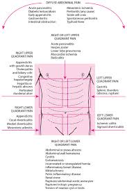 Acute Abdominal Pain Gastrointestinal Disorders Msd Manual Professional Edition