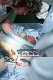 Image result for Neonatal Circumcision